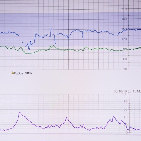 AI-based Patient Monitoring: Continuous Vital Sign Monitoring, Real-Time Detection of Anomalies & Alerting Medical Staff